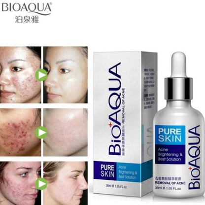 Bioaqua Acne Removal Serum Little chic