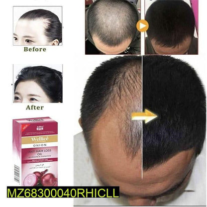 Anti hair loss onion oil 150 ml t4trendz