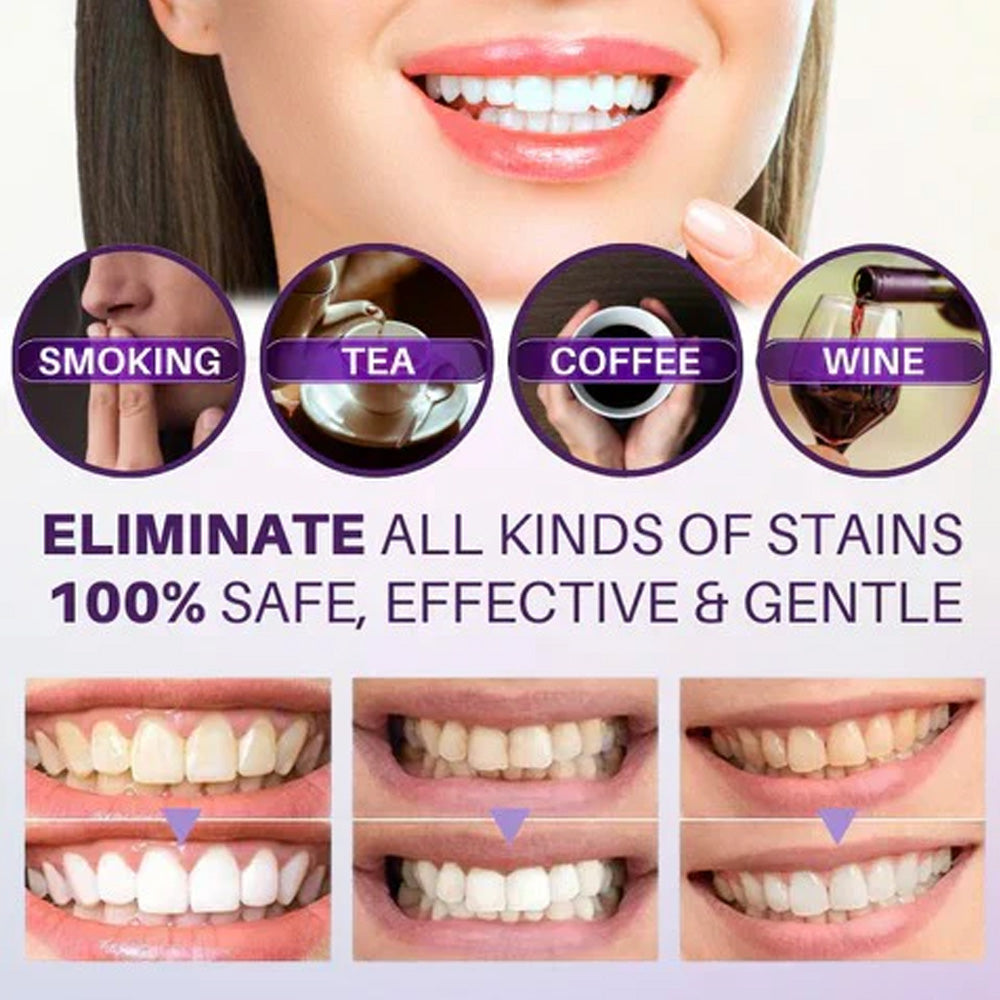 Hismile v34 Color Corrector Serum - Instant Teeth Whitening